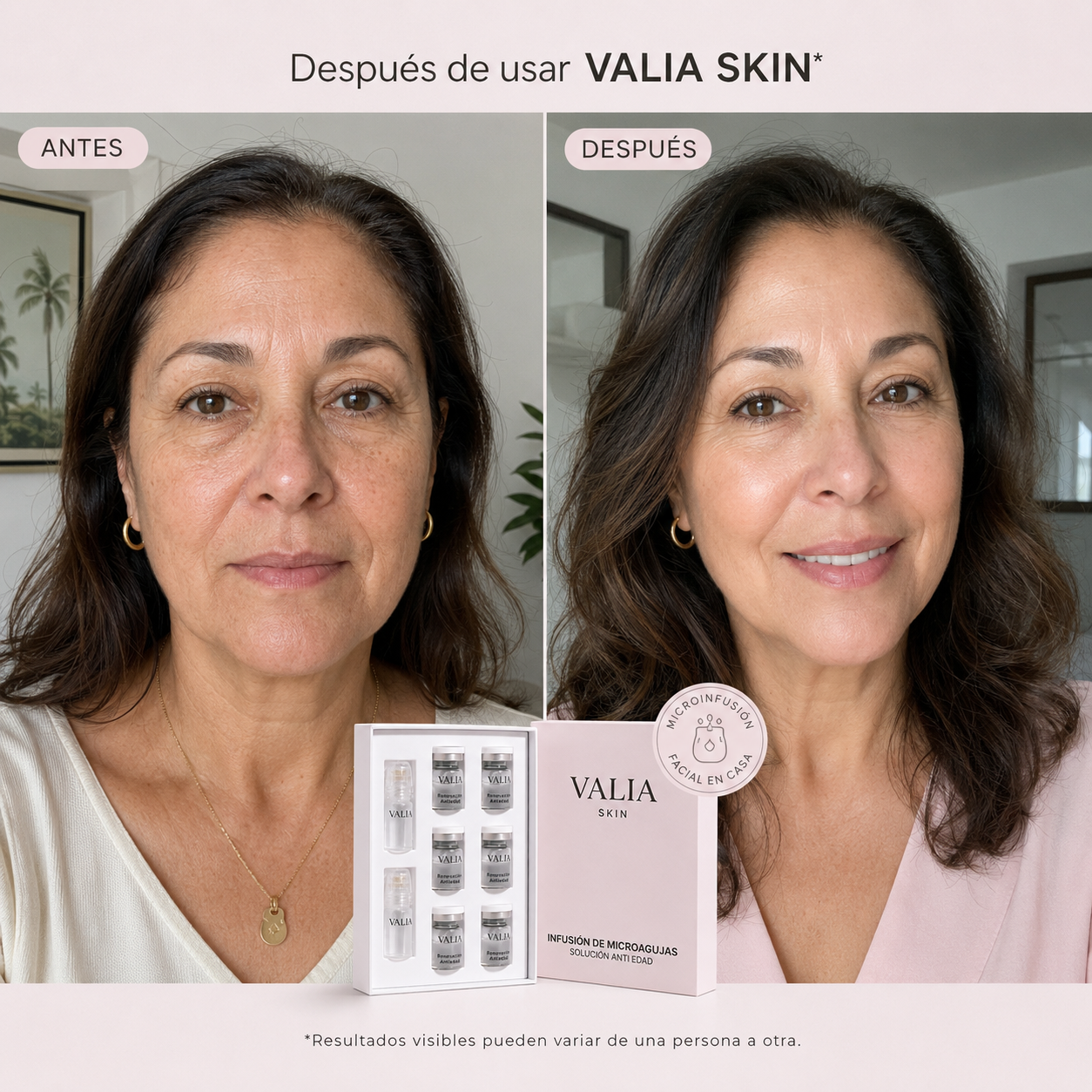 VALIA™ Tratamiento Microagujas Anti Edad