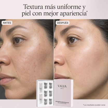 VALIA™ Tratamiento Microagujas Anti Edad